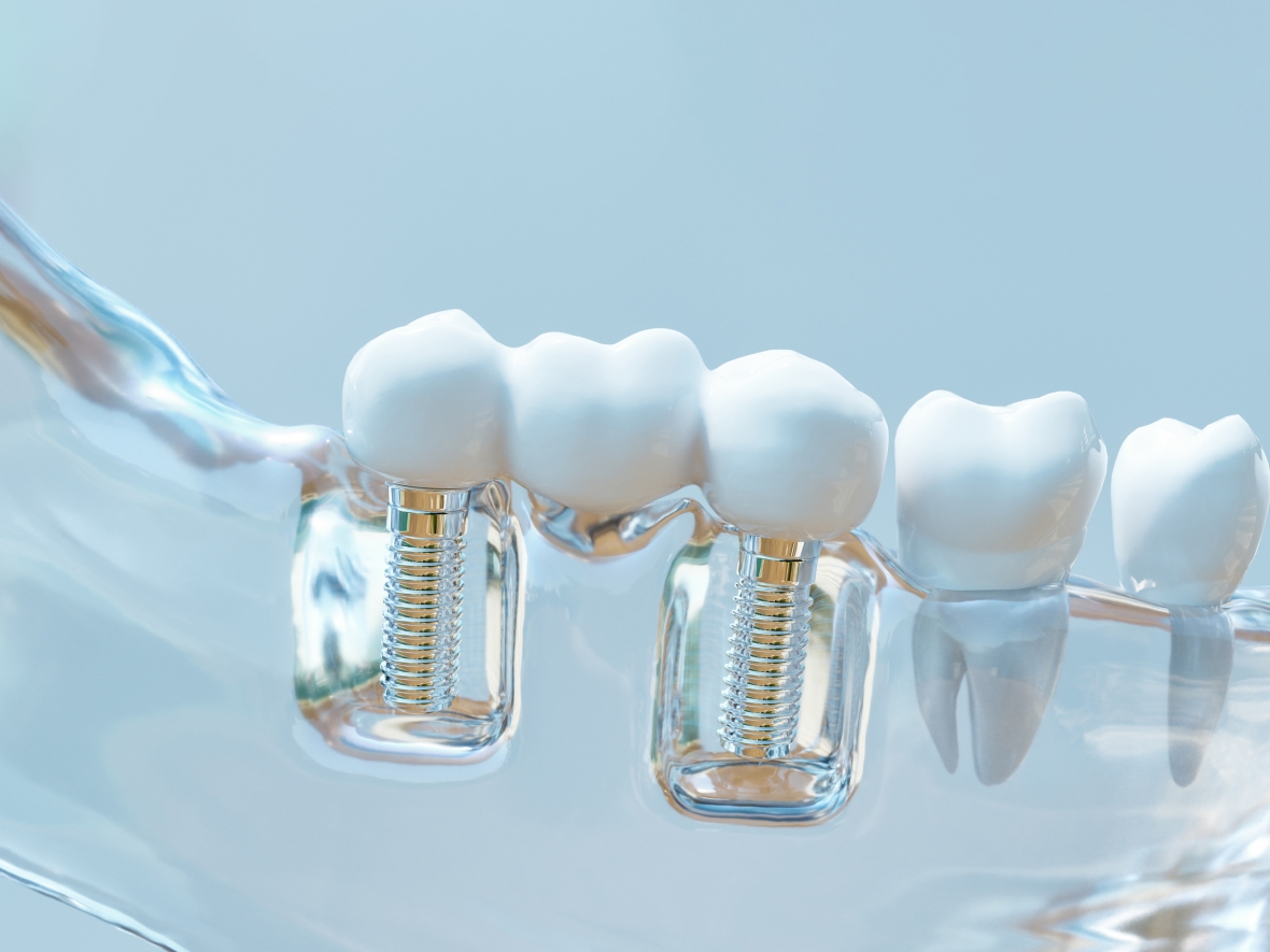 Треть сотрудников ждёт расширенное ДМС, ещё треть — компенсацию аренды жилья: соцпакет критичен для 95% работников