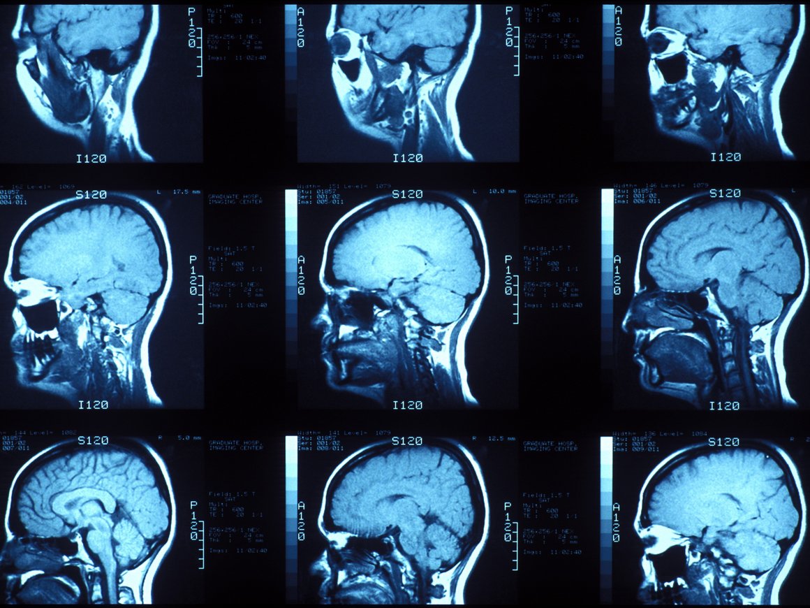 Ученые тестируют новый способ вывода пациентов из комы