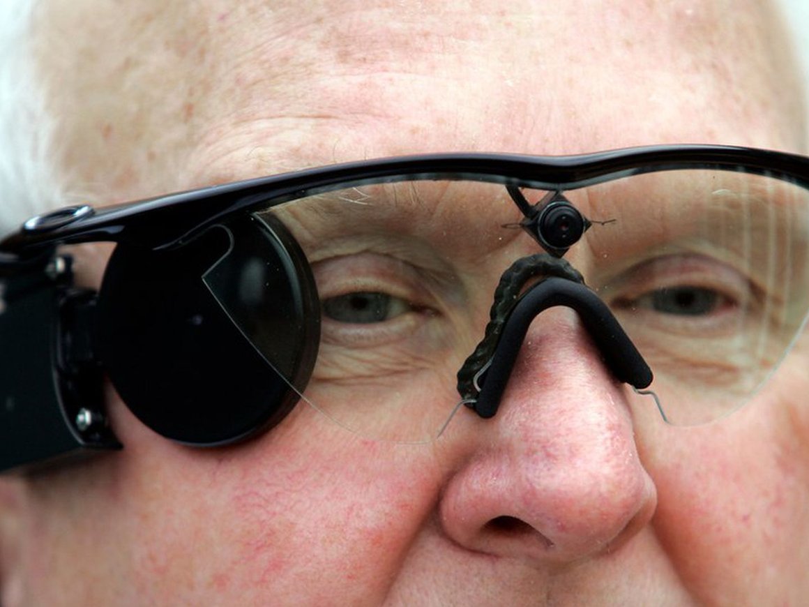 350 людей носят глазные импланты Second Sight. Несколько лет назад компания прекратила их обслуживать