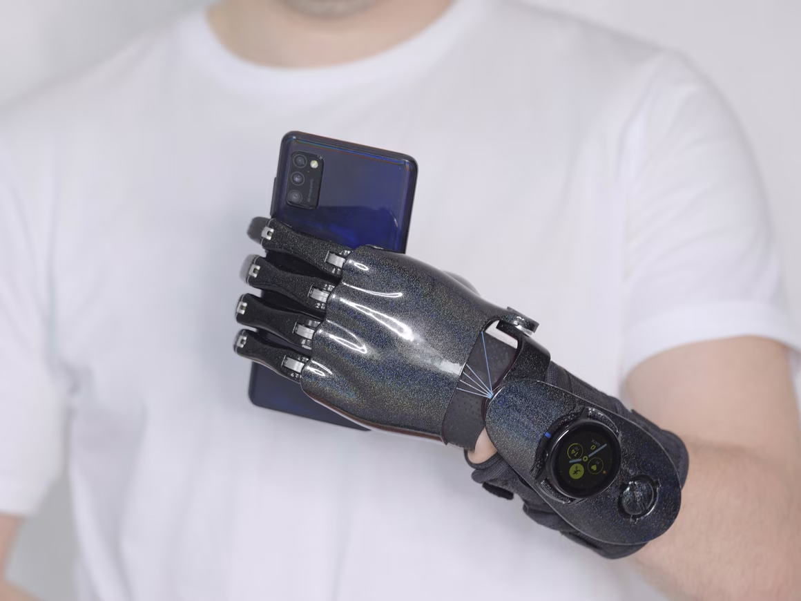 Samsung и стартап «Моторика» разработали систему управления протезами с помощью «умных» часов