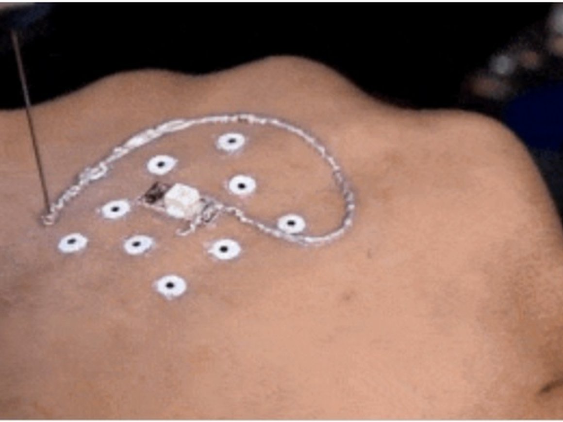 Видео: 3D-принтер научился печатать электронные устройства на человеческой коже