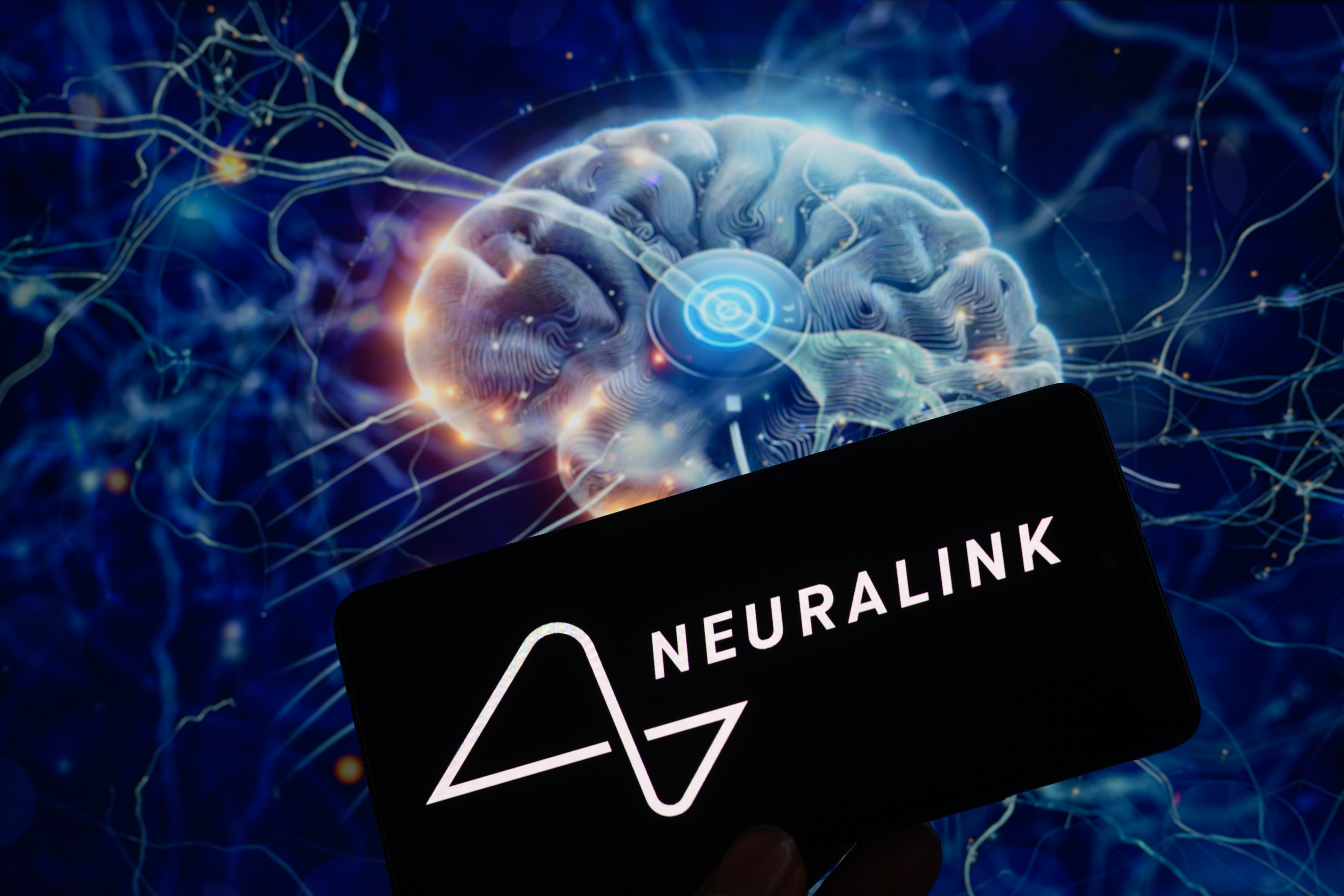 Neuralink Илона Маска получила разрешение на вживление мозговых чипов в Канаде
