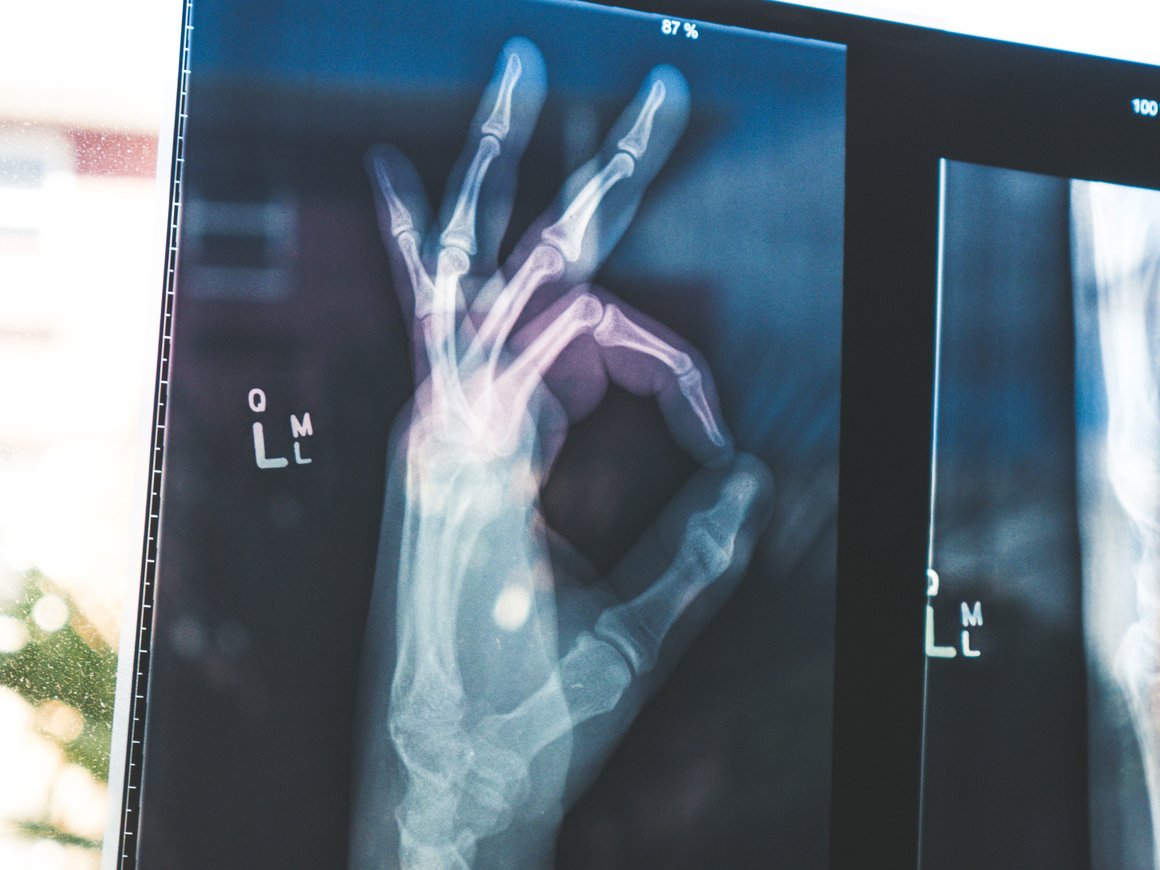 Инфографика: все о медтех-стартапах, использующих ИИ