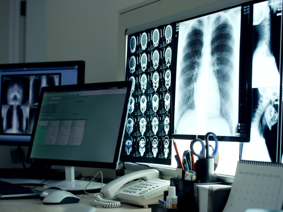 Уральские школьники создали систему для выявления патологий по рентгеновским снимкам