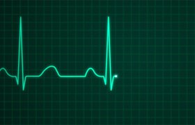 В реализацию флешки для снятия кардиограммы ECG Dongle вложили 18 млн рублей