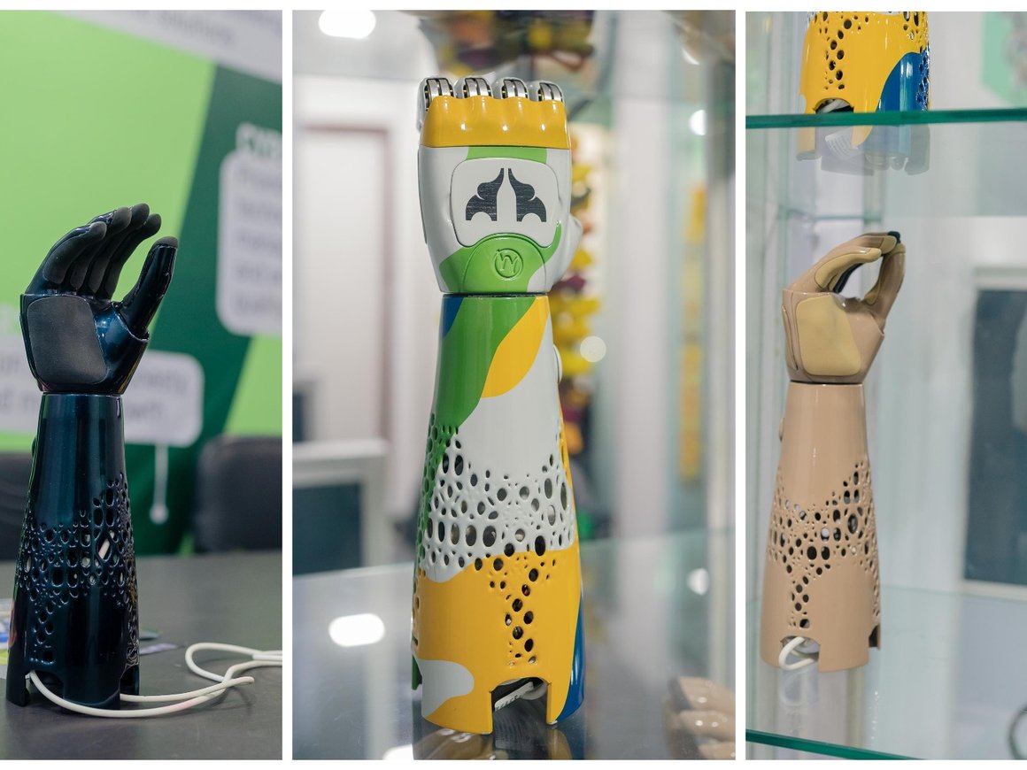 Производитель протезов «Моторика» открыл офис в Нью-Дели