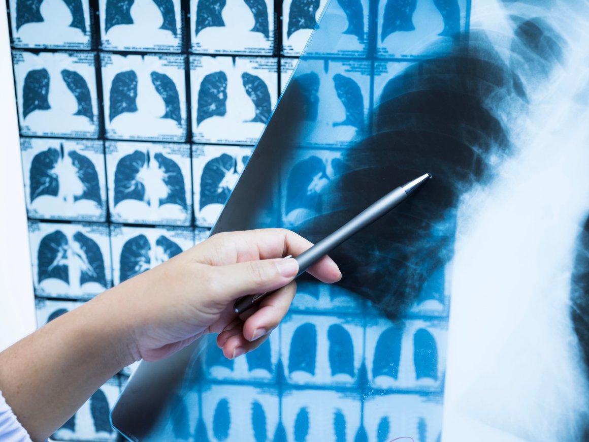 Как коронавирус помог определить недостатки алгоритмов ИИ