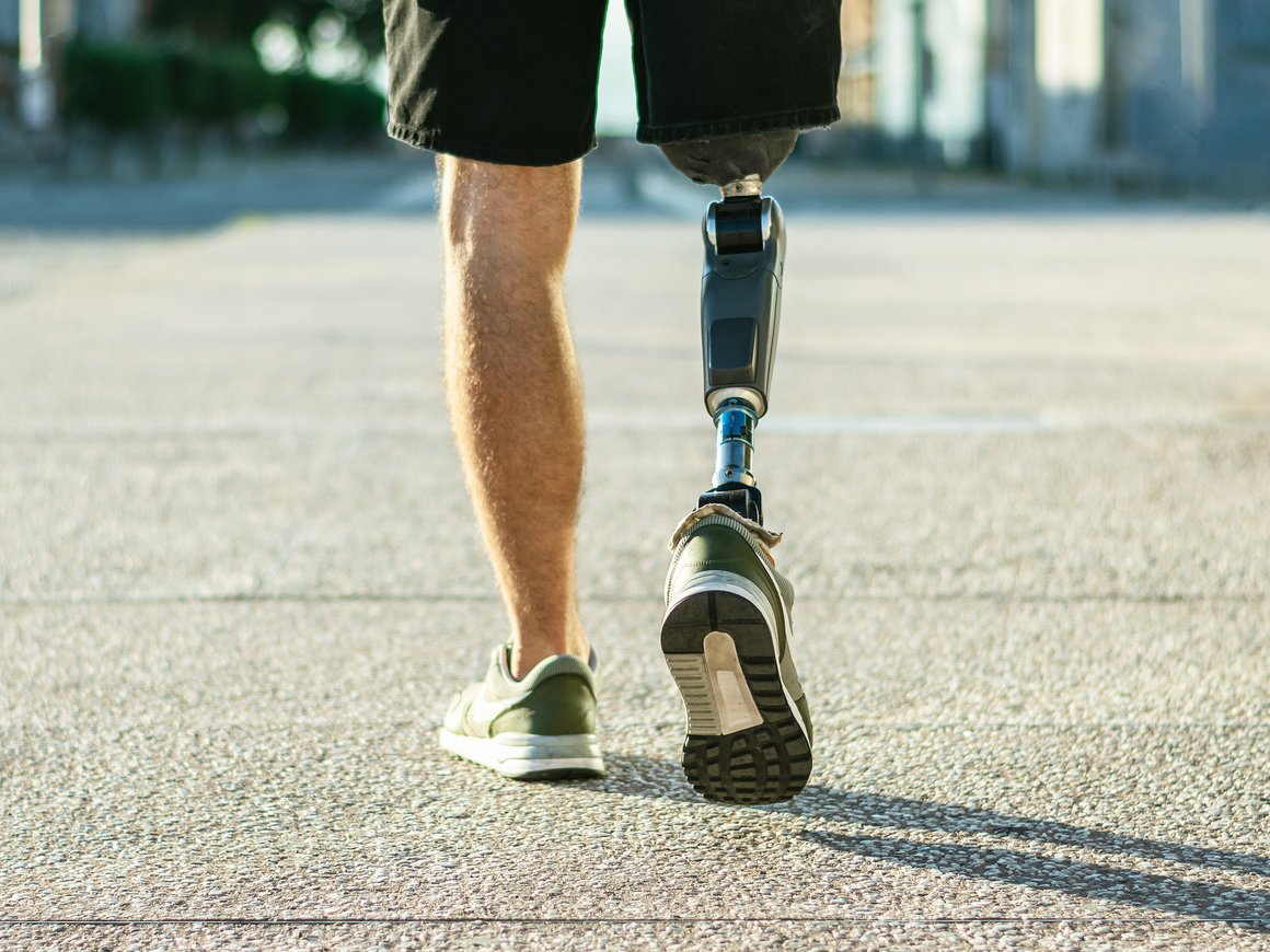 Разработчик протезов и нейроинтерфейсов «Моторика» изменил позиционирование