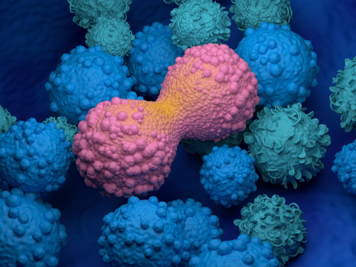 Резидент «Сколково» разработал помогающее выявлению рака молочной железы тестирование