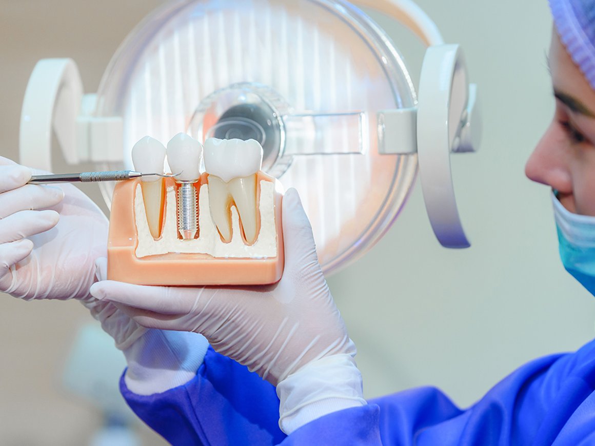 Робот-хирург Yomi помогает устанавливать зубные импланты — вот как он работает