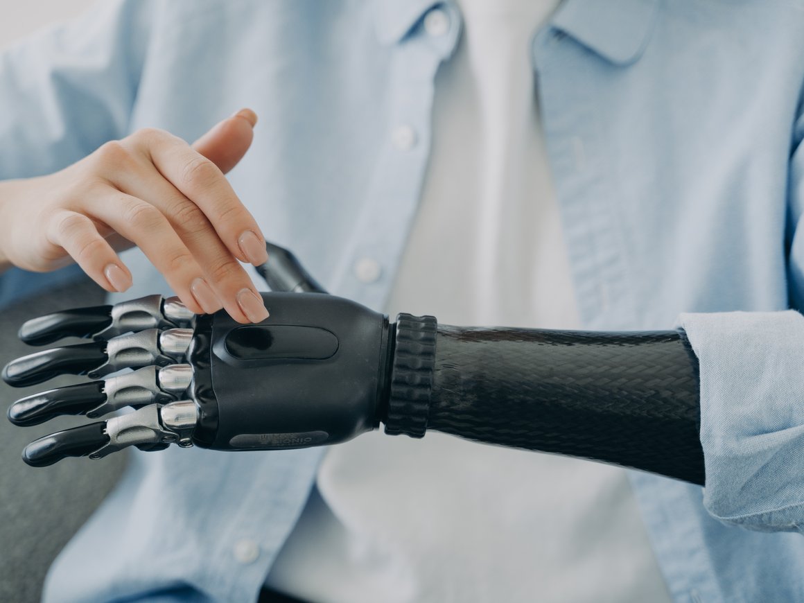 «Ростех» привлек 1 млрд рублей частных инвестиций на разработку экзопротезов