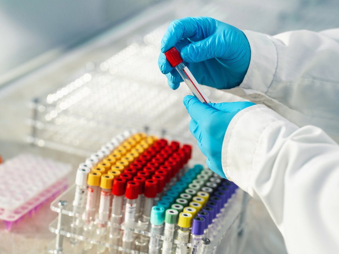 Лабораторной службе «Хеликс» грозит антимонопольный штраф до 1 млн рублей