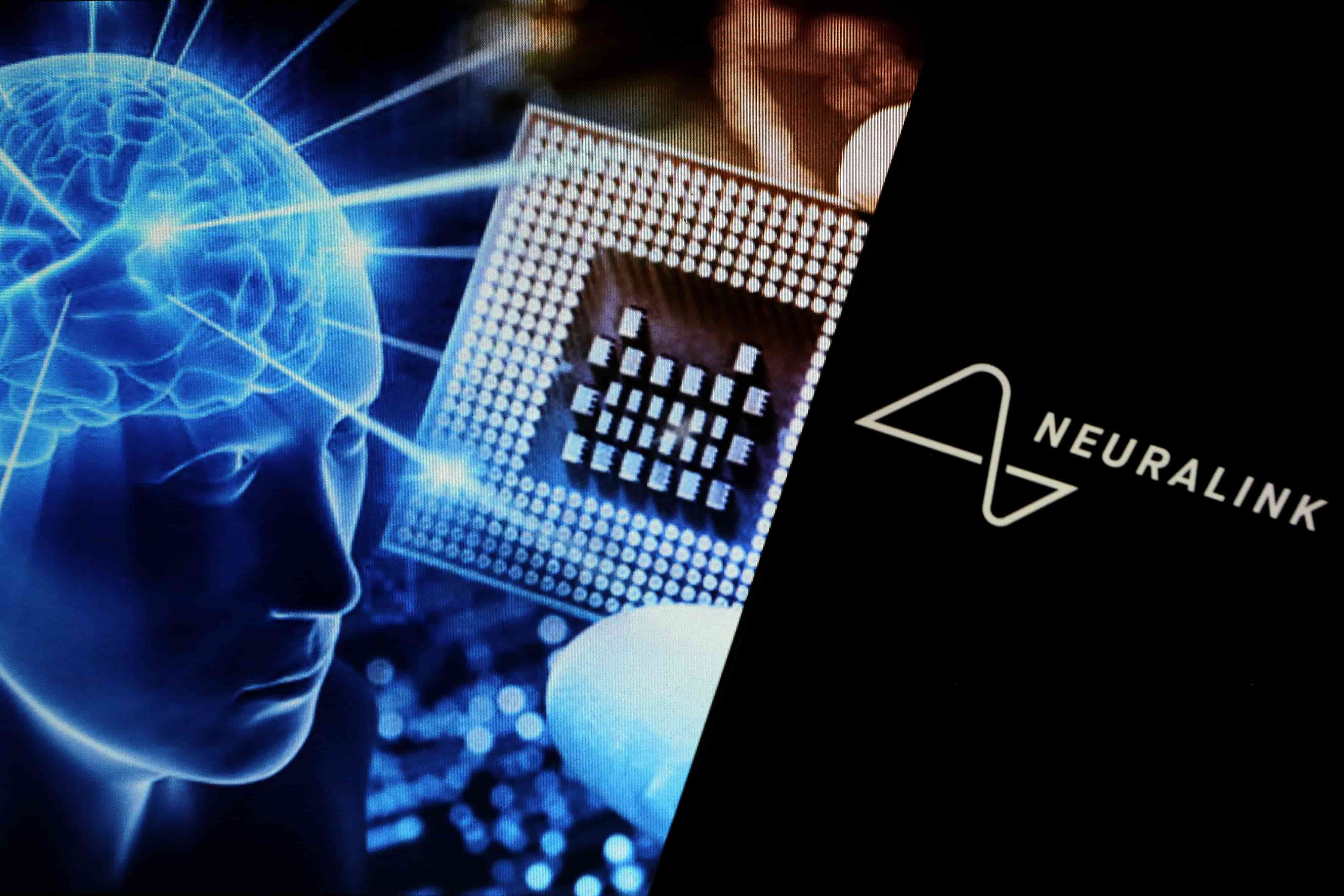 Neuralink получила разрешение на вживление мозгового нейроимпланта второму пациенту