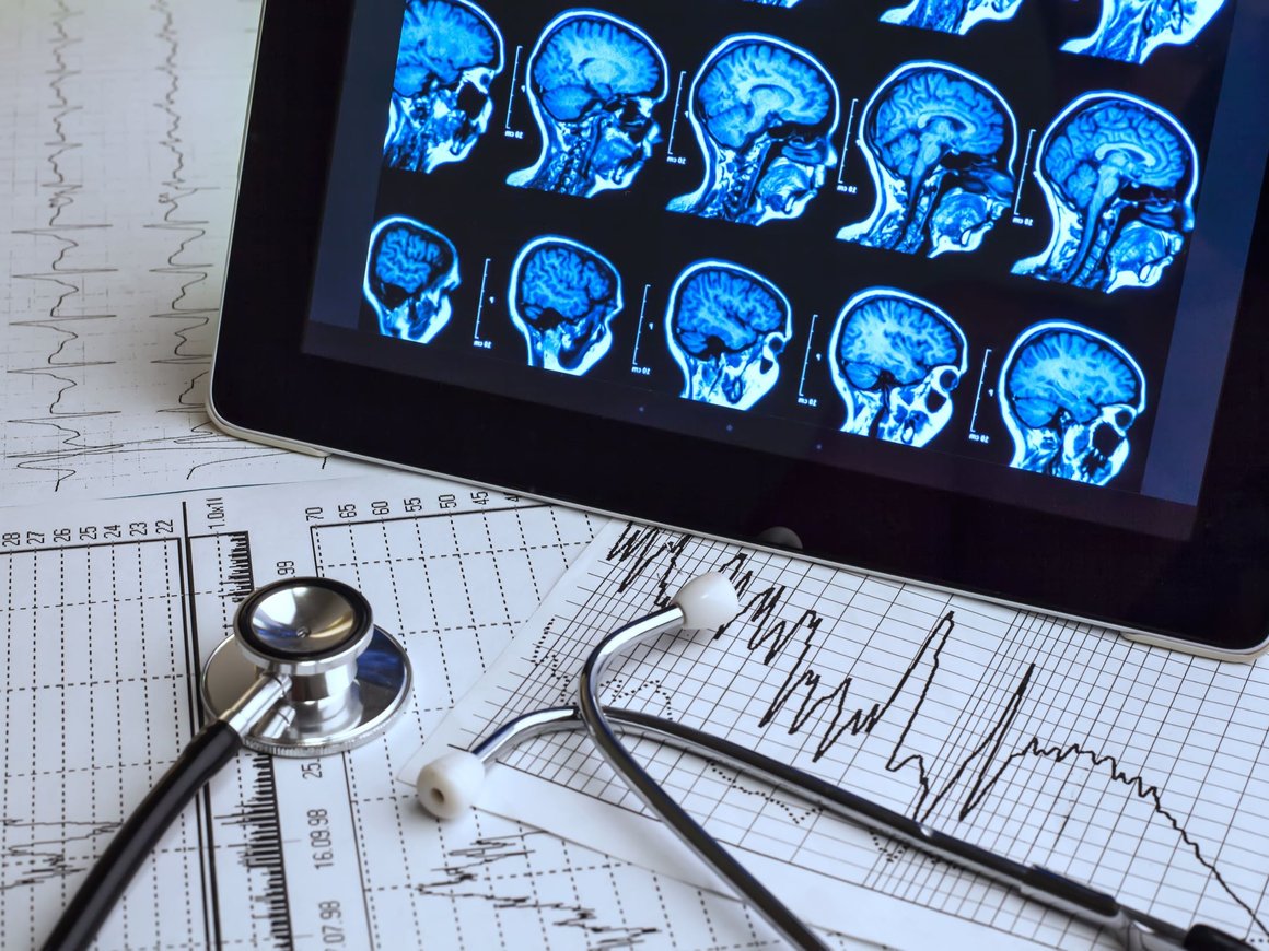 Нейроученые создали «декодер настроения», который позволит измерить депрессию